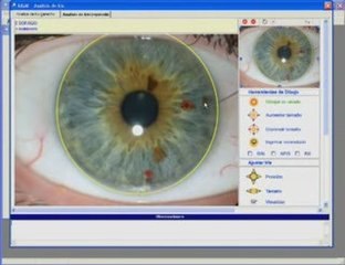 Iridologia Software