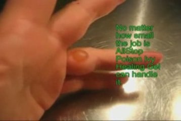 All Stop Healing Gel can get rid of Blisters.