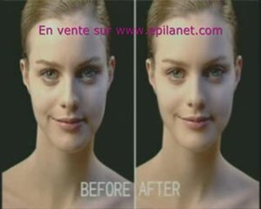 Up5 anti-age lifting anti-ride anti-rides soin de la peau