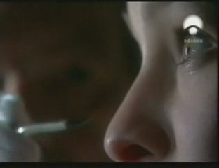 Parafinoma: Origenes de la cirugía estetica