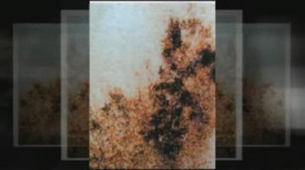 Mold Removal Westchester - IAC Moldbusters