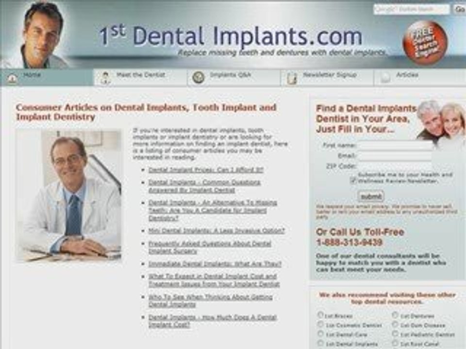 Want Dental Implants?