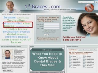 Searching for a Braces Dentist for Ceramic Braces?