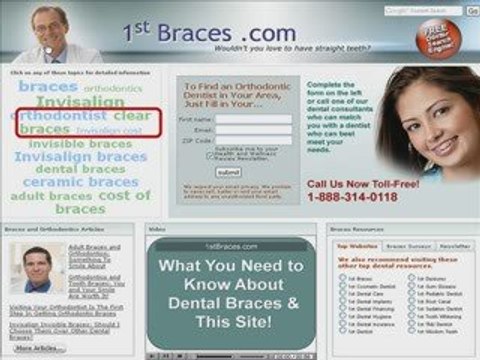 Searching for a Braces Dentist for Ceramic Braces?