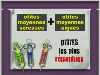 LA MINUTE DE LA SANTE - L'otite