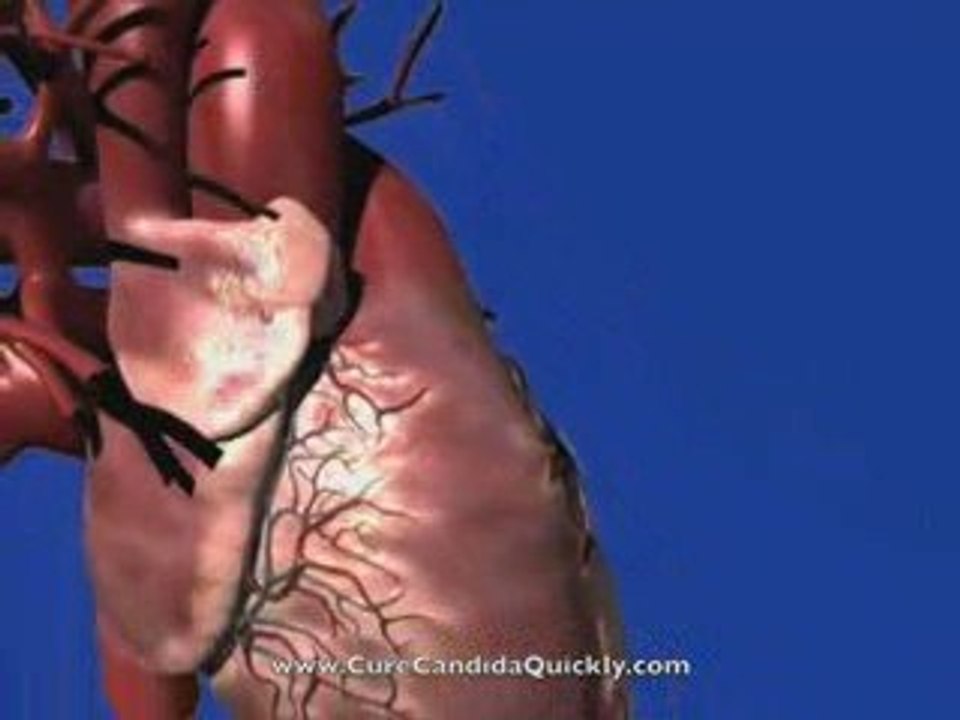 Male Yeast Infection Cure - Oral & Candida