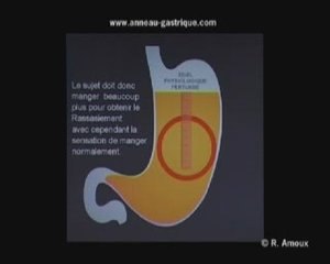 Présentation de l'association l'Anneau de l'Espoir