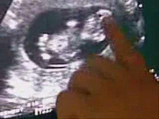 bb de Mr et Mme Bouadma