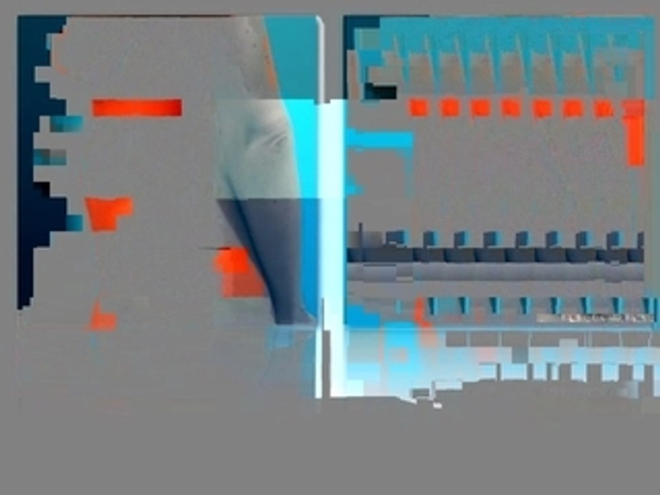 Tummy Tuck - Abdominoplasty - Dallas Texas - Dr Bogdan