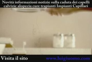 Caduta dei capelli  Visita il sito http://www.luigiuomo.com