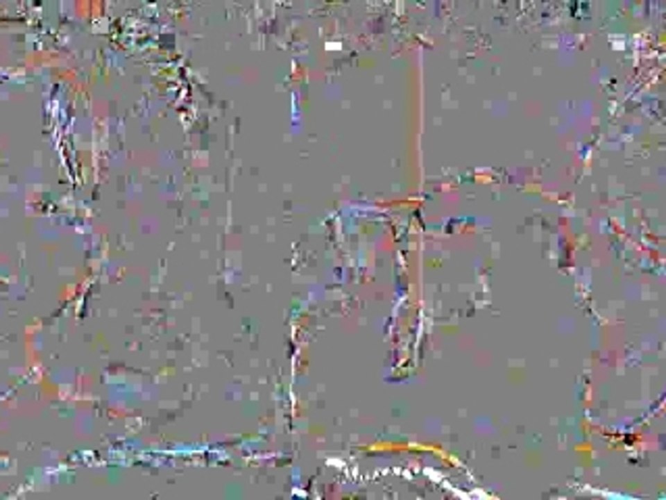 Veneers Ft Myers, Veneers Naples, Veneers Cape Coral