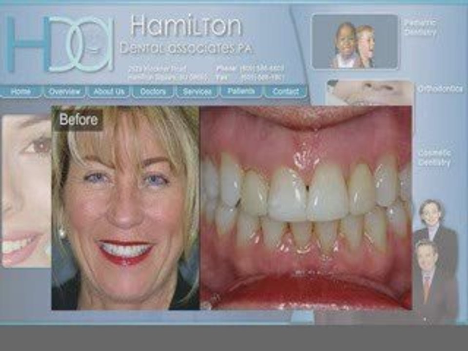 Hamilton Dentist