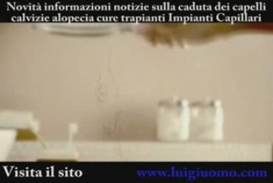 Impianti capelli, visita il sito luigiuomo.com