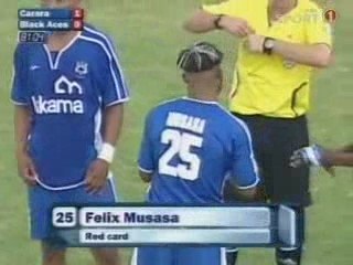 Jambe cassée football