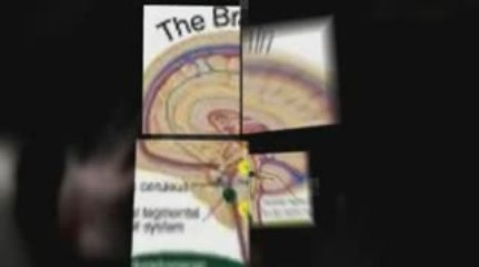 chronic depression symptoms