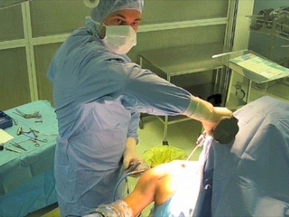 Traitement chirurgical des luxations acromio-claviculaires