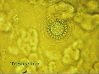 Recherche parasitaire étape 3 "les parasites"