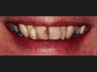 Dental Cosmetic Surgery  What Parents Should Know About Dent