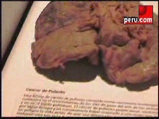 Peru.com: Exhibición "El cuerpo humano, real y fascinante" 3