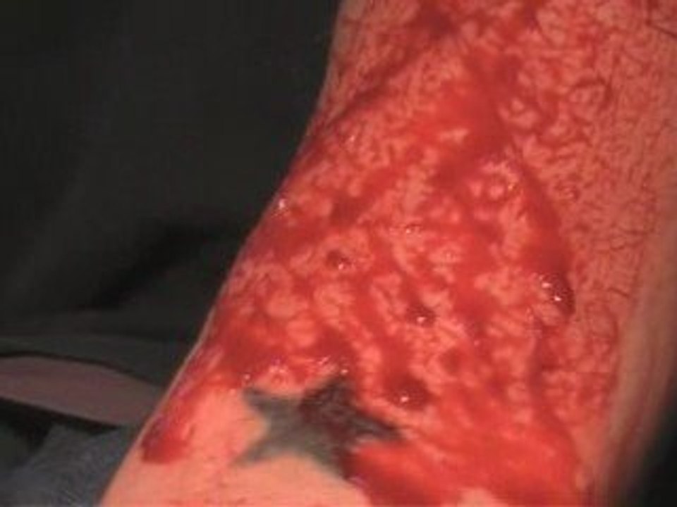 1surG (punk AnArKoTiK) ska-riff...