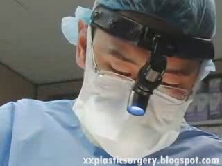 Nose Plastic Surgery