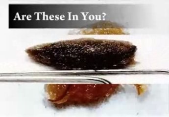 Got Parasites?