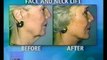 Dr. Darrick Antell speaks with NBC on plastic surgery