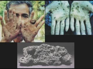 We are being poisoned - Our Water