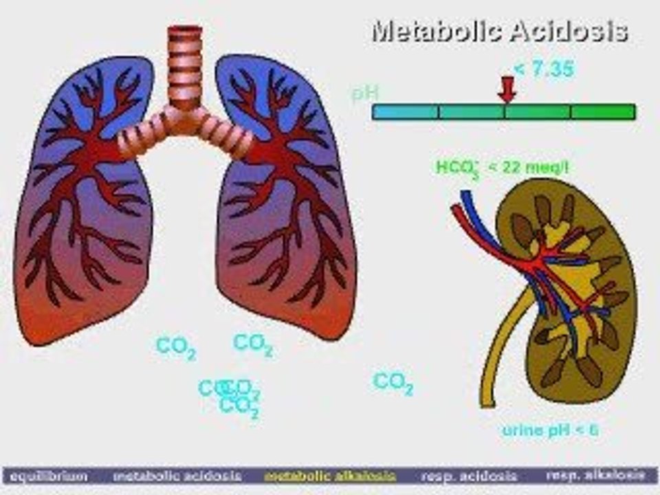 NurseReview.Org - Acid Base Balance