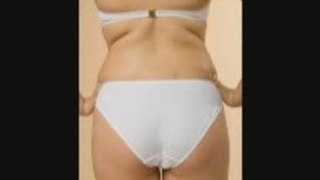 The Right Information About Treatments For Cellulite