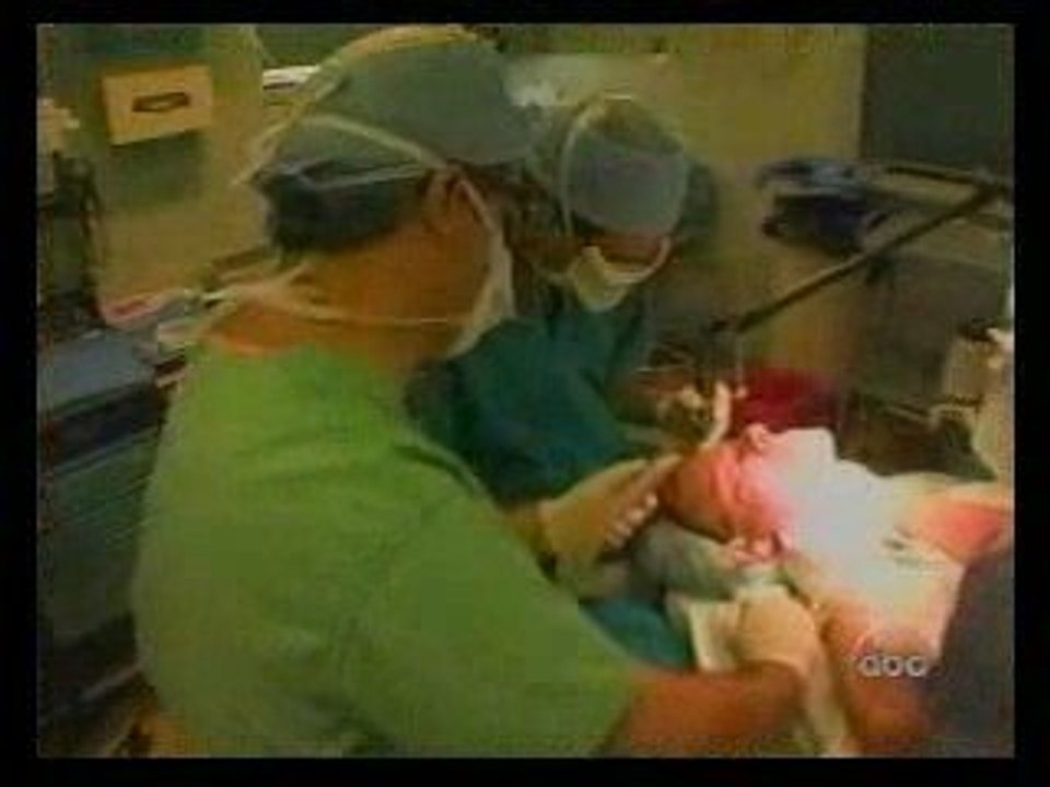 Dr. Antell on Good Morning America and Male Plastic Surgery